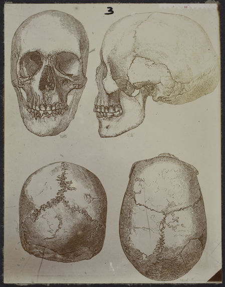 Ellipsoïdes sphyroïdes (Néolithique) Angleterre [crâne dessiné]