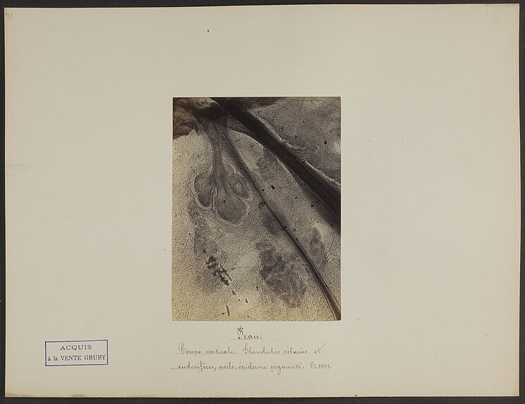 Peau. Coupe verticale. Glandules sébacées et sudorifères, poils, épiderme pigmenté