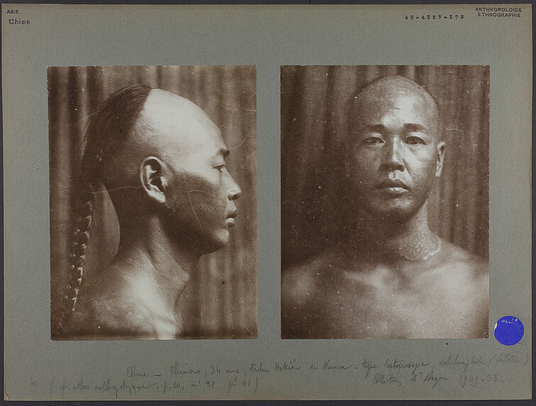 Chine - Chinois, 34 ans, tribu Hokien de Namoa, type leptoprosope, dolichocéphale
