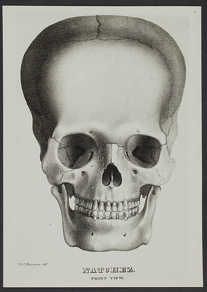 Crâne de Natchez