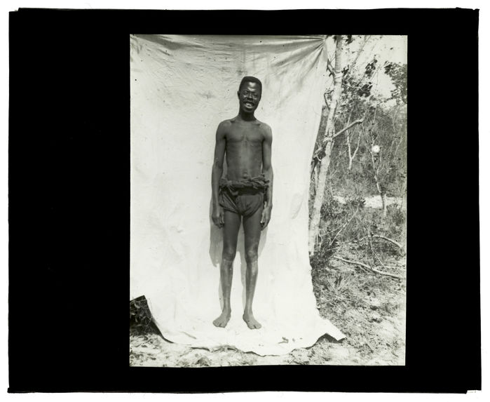 Type de Luchazi, bords de la Luanginga, 25 septembre 1913 [homme de face]
